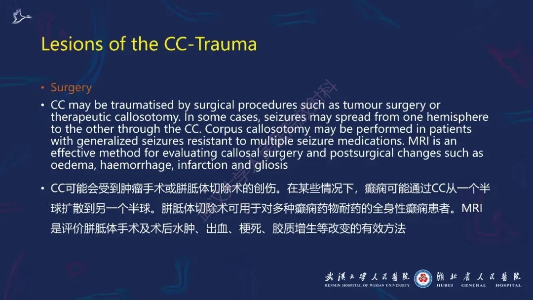 胼胝体肿瘤影像鉴别,胼胝体病变影像诊断