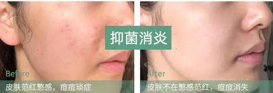 张韶涵新西兰化妆品,张韶涵美妆品推荐