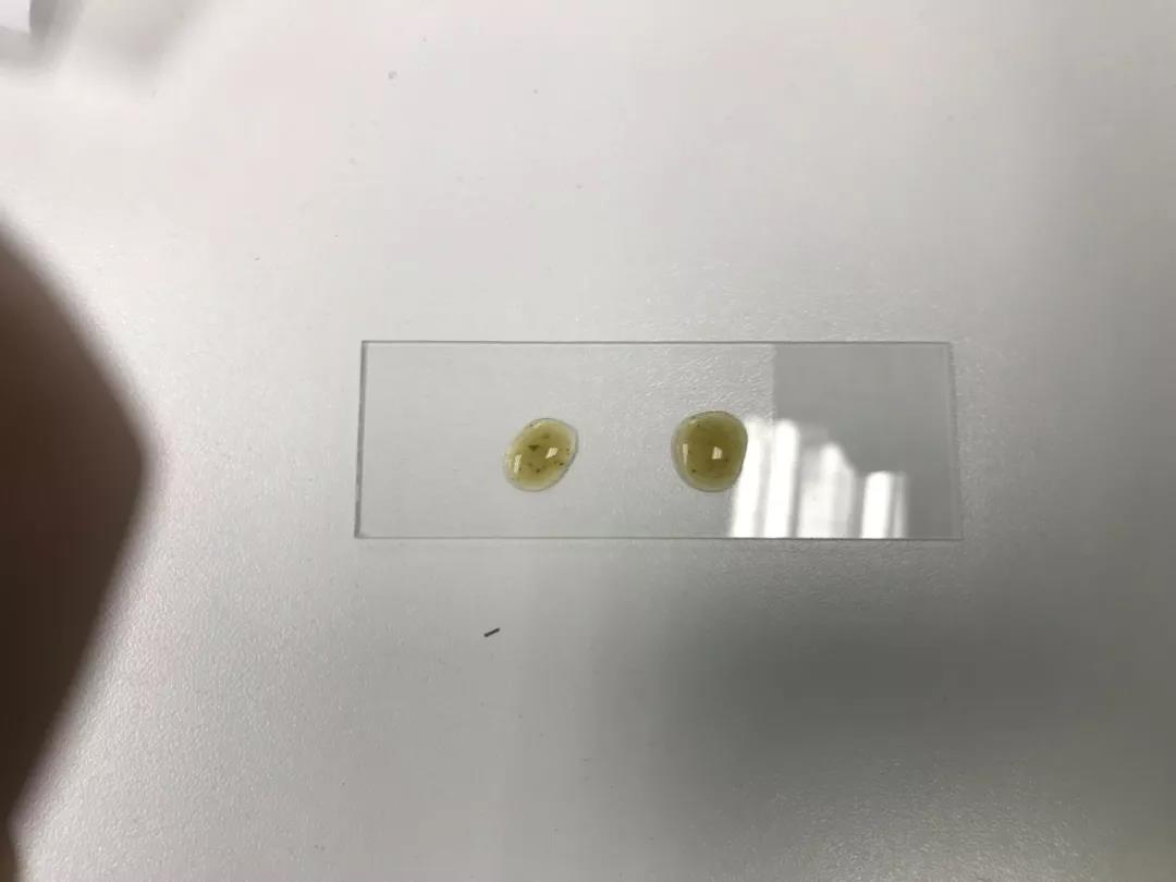 龟拉稀就是肠胃炎吗?还有可能是你不知道的寄生虫!