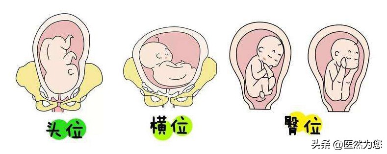 孕期总担心胎儿不健康怎么办,孕妇胎位不正医生纠正标准动作