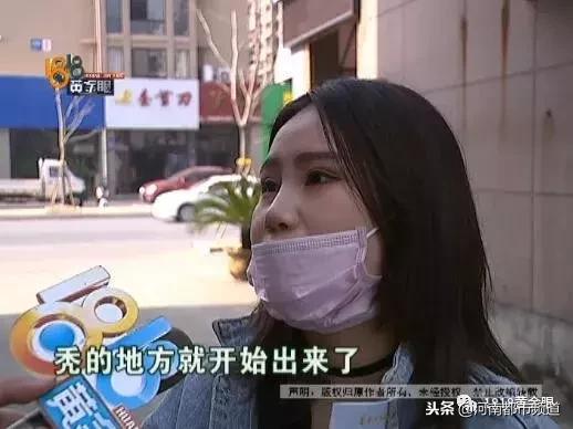 杭州漂亮女孩扎马尾头皮一下秃了四块！她怀疑那次在理发店……