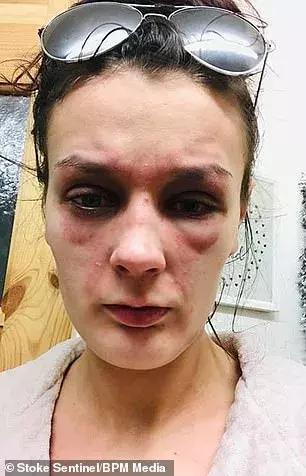 因为一时疏忽让自己悔恨终生,因为一时的疏忽造成了终身后悔