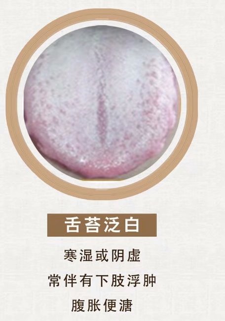 舌诊脉诊分析合集,舌诊实战分析