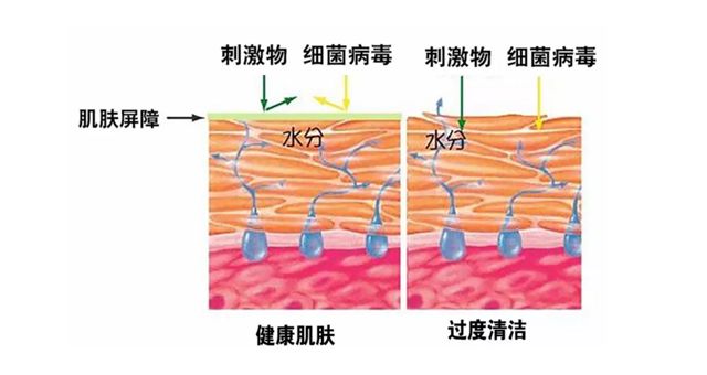 怎么样才能使角质层变薄,手部角质层变薄灼伤角质层