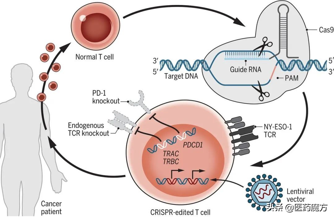 crispr治疗肺癌安全吗,crispr肺癌