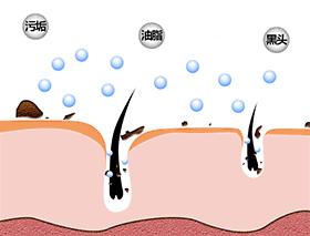 如何从根本上解决黑头问题,黑头太顽固教你去黑头的方法