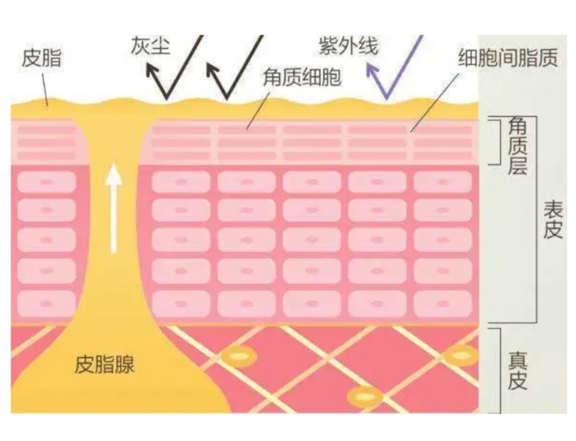 皮脂腺怎么处理,皮脂腺大怎么办