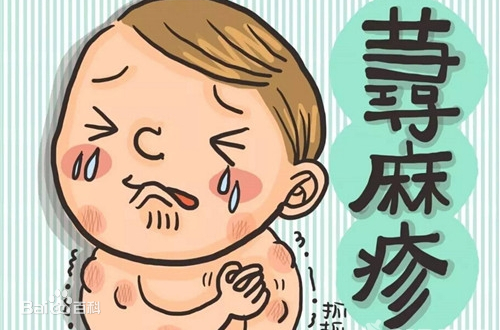 一岁儿童荨麻疹最简单自愈方法,儿童麻疹症状