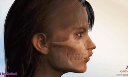 一笑就露牙龈怎么办,一笑牙龈露太多怎么治疗