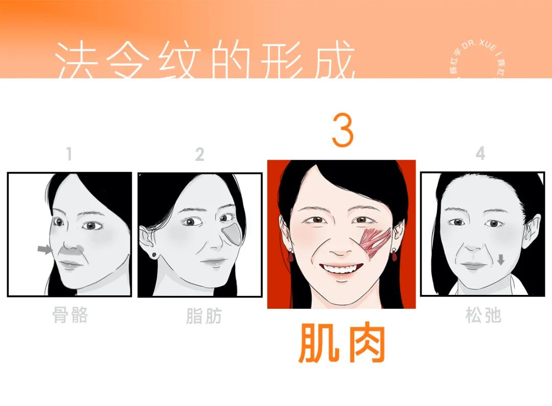 脾胃好了法令纹会改善吗,面部瑜伽能改善法令纹吗