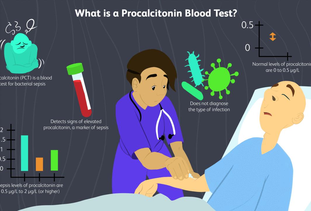 寄生虫操纵人类大脑,操纵意识的寄生虫