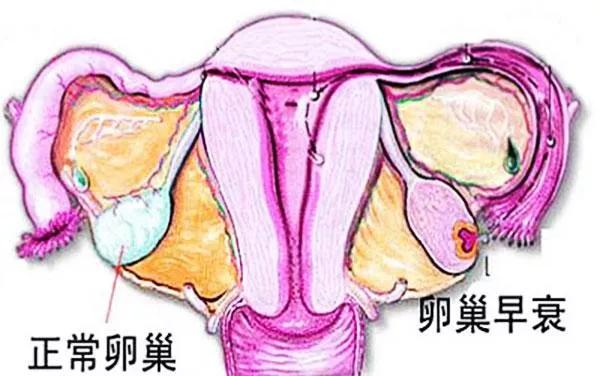 卵巢早衰脸上会有什么变化,40岁女脸皱纹多是卵巢早衰吗