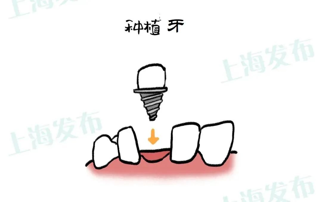 怎样缓解牙疼引起的牙神经疼痛,关于牙疼健康问题的对话简短