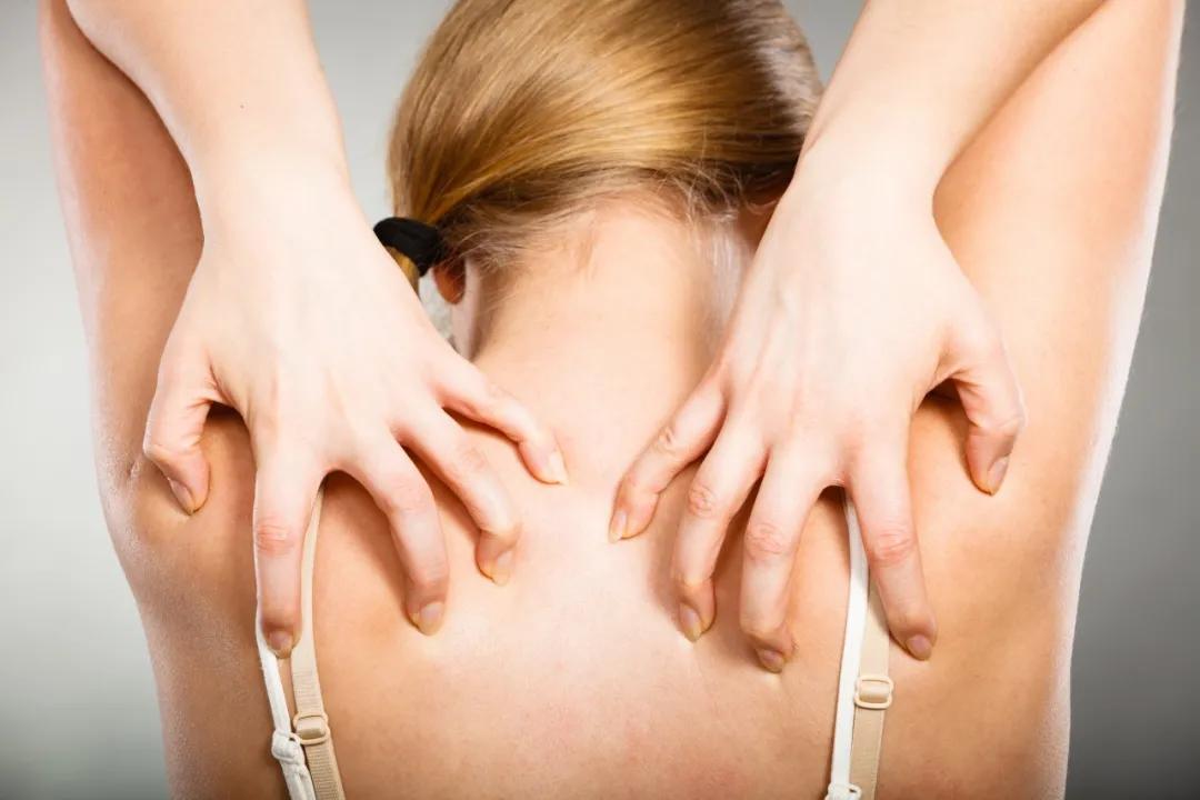 清亚灵告诉你：洗澡后皮肤奇痒还掉屑！秋冬皮肤干痒，如何应对？