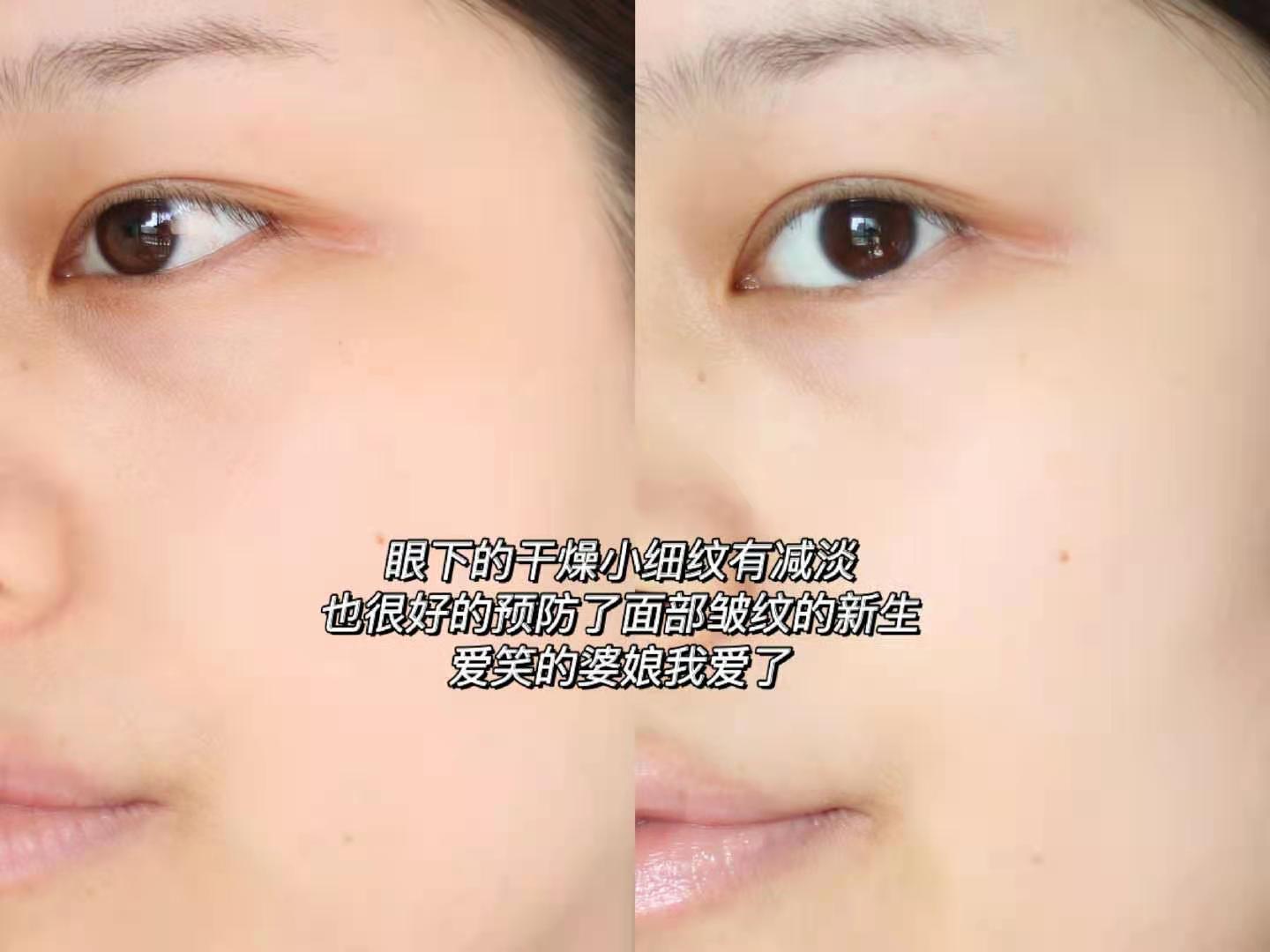 露得清a醇抗皱修护眼霜怎么用,露得清a醇眼霜能去黑眼圈吗