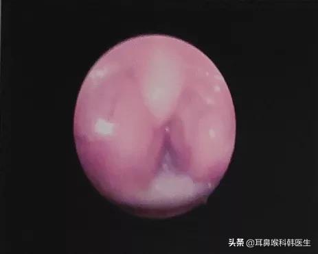 为啥来院就做内镜检查?医生怕是在骗我钱吧