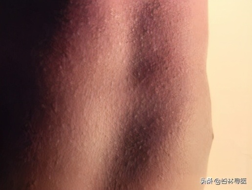 儿童嗓子发炎化脓快速解决方法,孩子喉咙发炎化脓怎么治疗最快