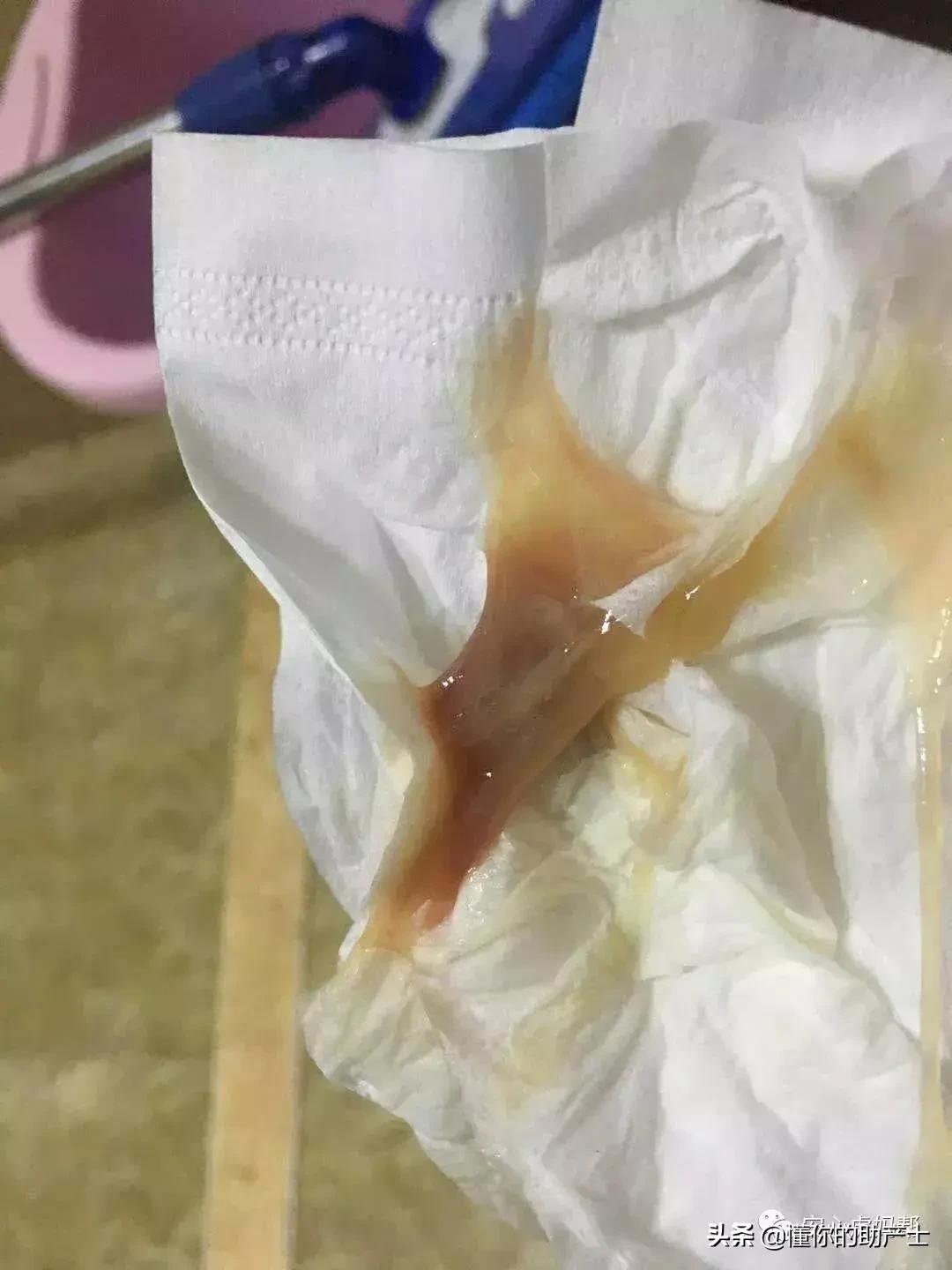 孕期要注意什么细节,孕期室内注意事项