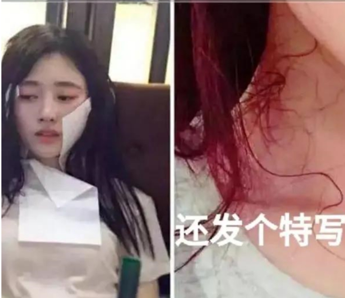 鞠婧祎1人用5替身引爆热搜,鞠婧祎被蚊子咬现代剧