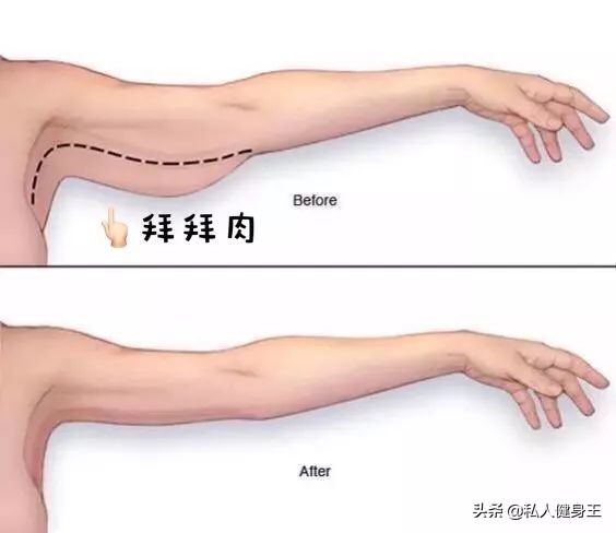 众多女明星的手臂都很粗，是如何瘦下来的？这五个动作助你瘦手臂