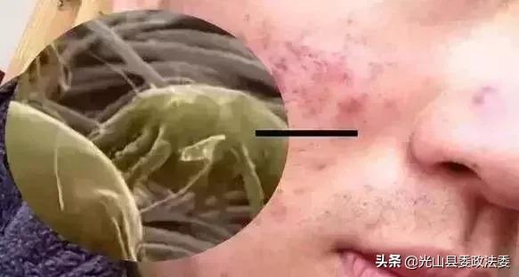 长期盖蚕丝被有什么危害 (长期盖蚕丝被被曝光)