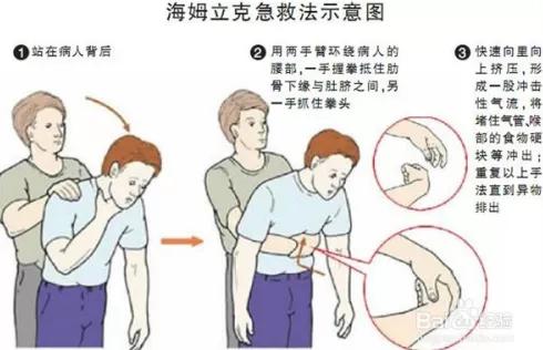 婴儿异物卡住喉咙案例,宝宝咽鱼刺卡住的状态