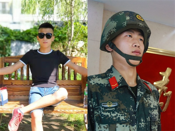 当兵前可以整容吗,当兵为什么要整容