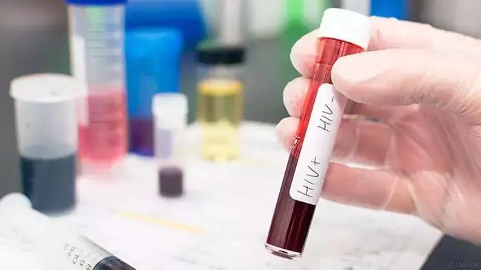 多数人感染艾滋都是无症状的吗,通过性传播艾滋病的概率有多大