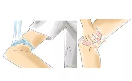 干货！国家体育总局运动医学博士的总结：运动损伤的急救和预防