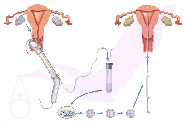 女孩*市黑**卖卵赚钱？身体的疼，还不是最可怕的