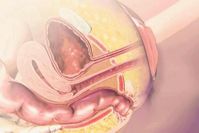 生产后肚子松松垮垮,产后运动肚子赘肉多久能恢复