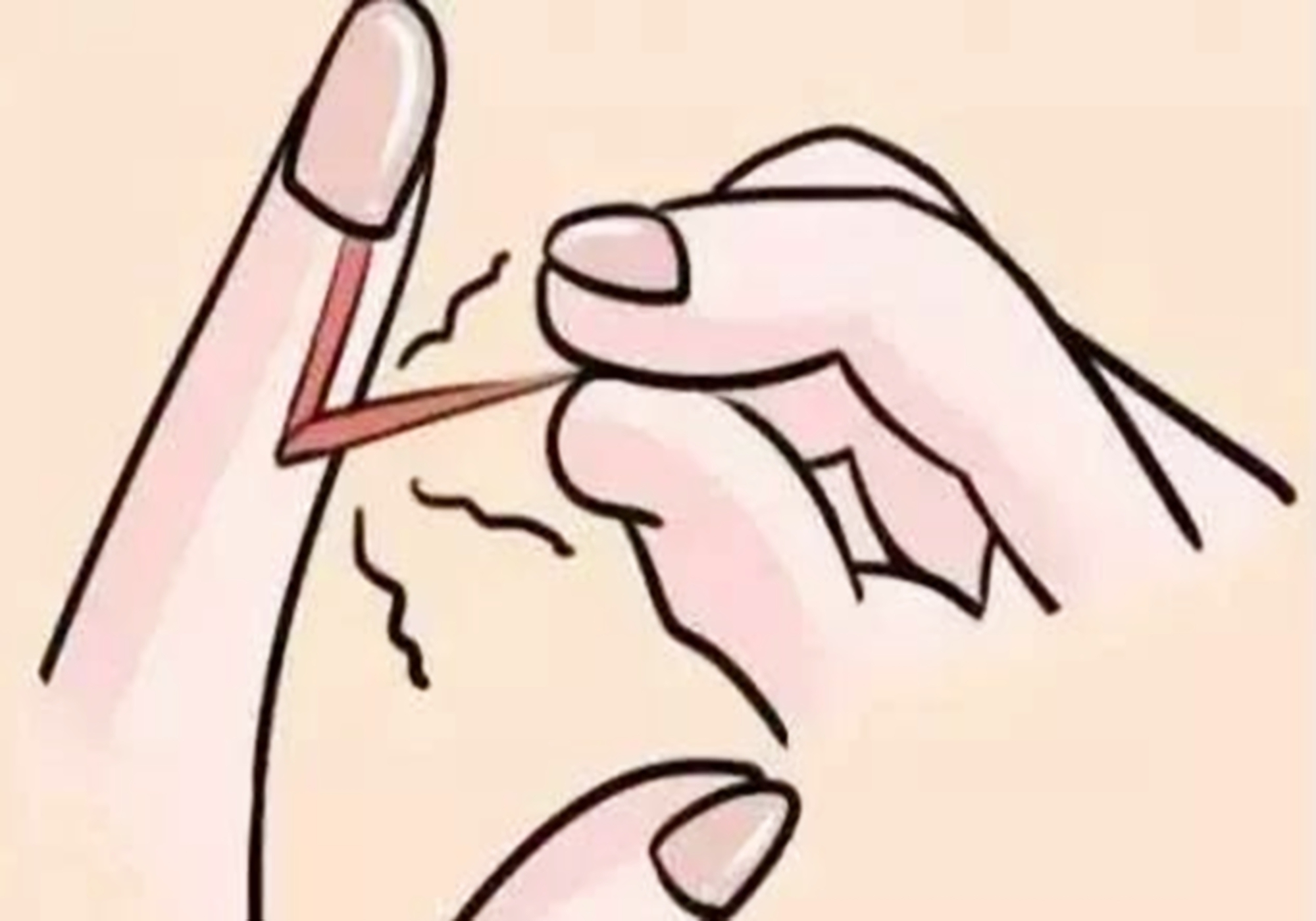 小孩脚大拇指底长倒刺是怎么回事,大拇脚趾指肚上长倒刺是什么原因