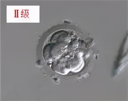 胚胎评级4bc什么意思,胚胎以什么标准评级