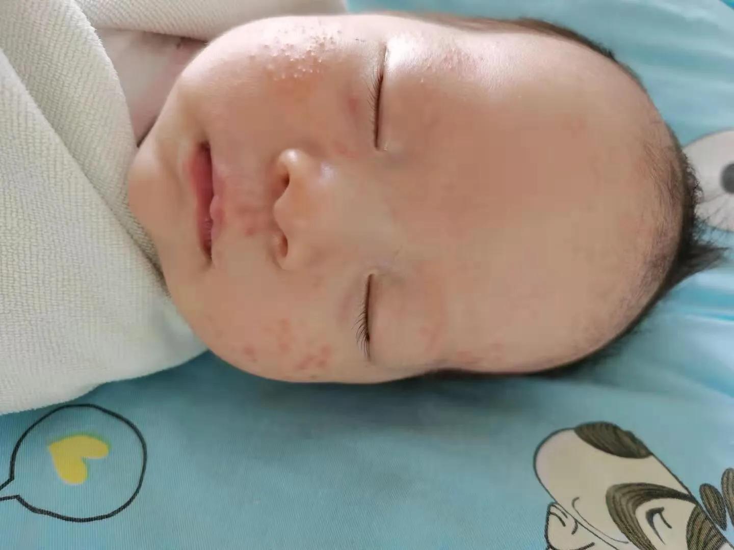 宝宝生病住院是妈妈最大的崩溃,未满月的宝宝一直哭