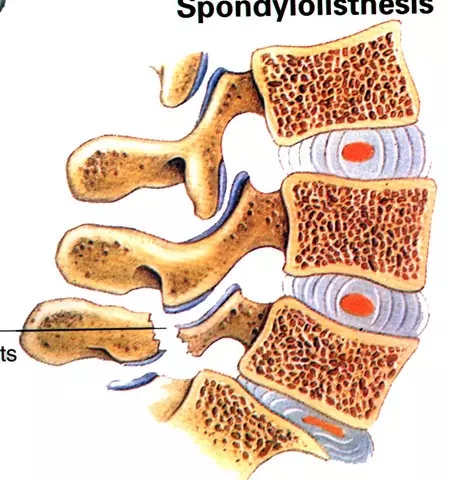 颈椎腰椎疾病ct及mri诊断,腰椎ct可以发现肠部病变吗