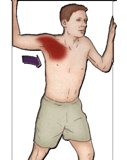 肩痛的原因及症状,突如其来的肩痛实在是难以忍受