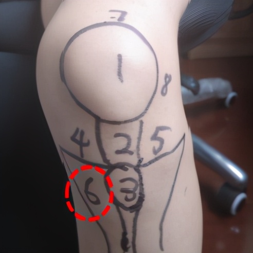 膝盖痛12种疼痛对照表图解,不同部位膝盖疼痛的原因