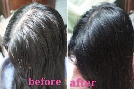 李佳琦好物分享去屑洗发水,李佳琦堪称洗发水界的阿玛尼