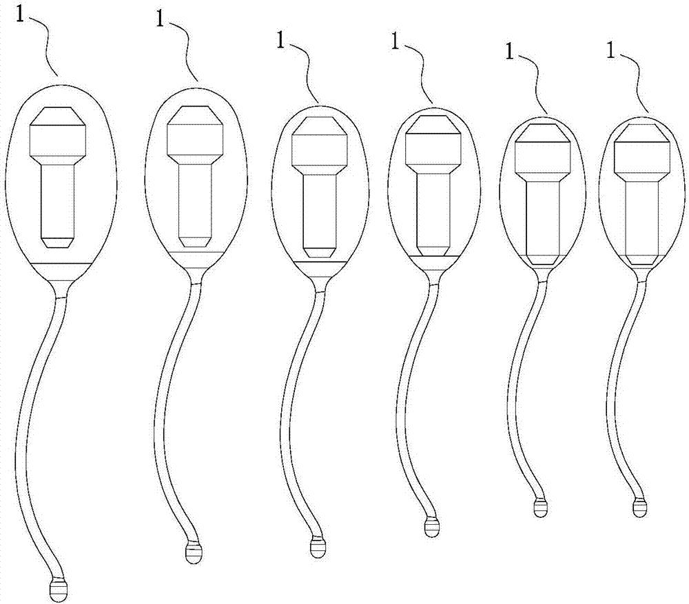 盆底康复治疗梳理，盆底康复治疗不能预防只能缓解性治疗