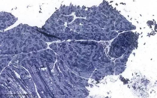 消化道出血高钾血症治疗,诊断高碳酸血症的金标准是什么