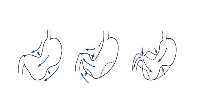 胃痛为啥吃胃药反而更痛,胃痛吃了药也是痛