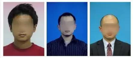 怎么拯救你我的发际线,如何通过改善发型拯救发际线