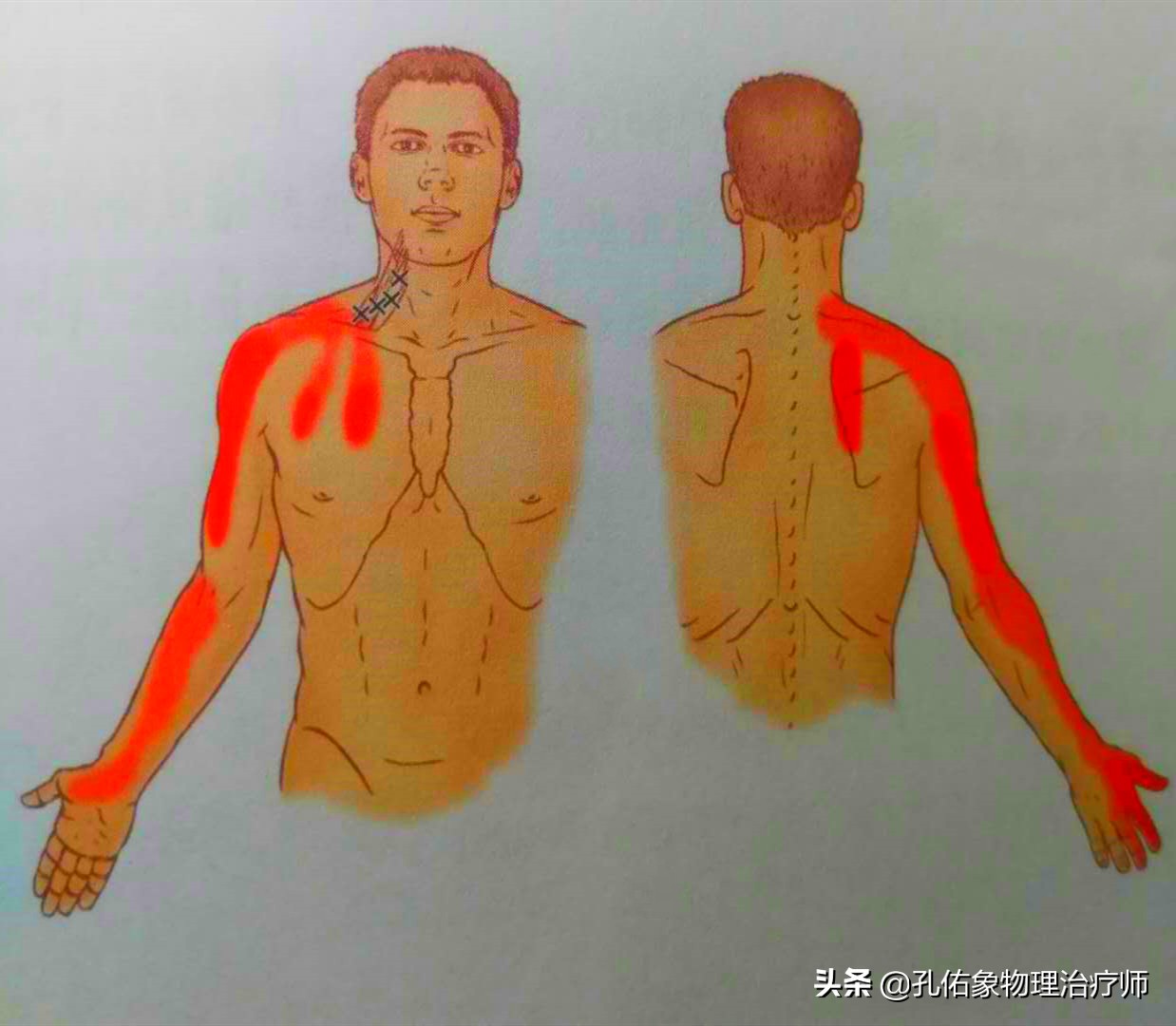 手指麻木是三大疾病前兆,手指麻木疼痛怎么治疗最好