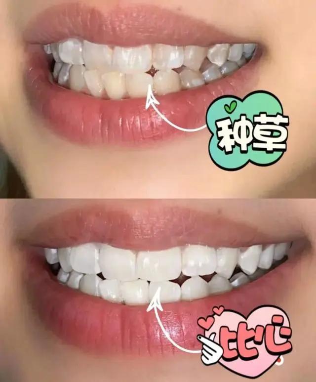 一张嘴就臭是咋回事,刷牙不管用的口臭怎么治