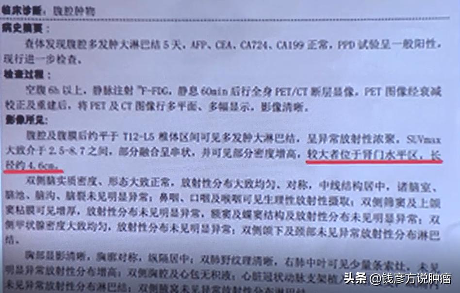 惰性淋巴瘤可以切除吗,惰性淋巴瘤化疗效果如何