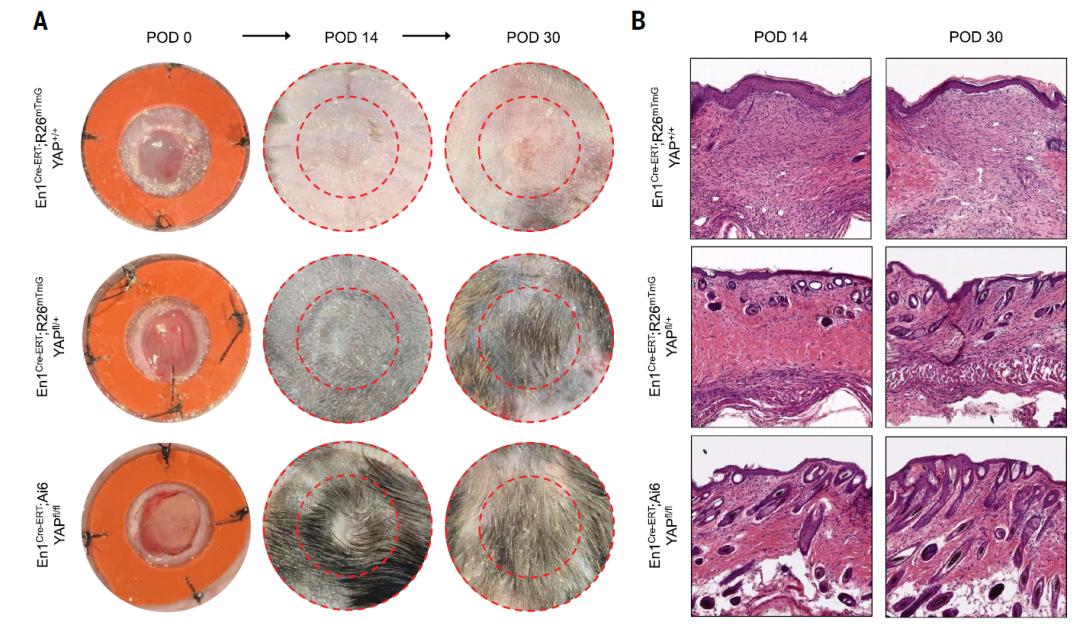 斯坦福大学科学家发现了让伤口不留疤痕愈合的方法