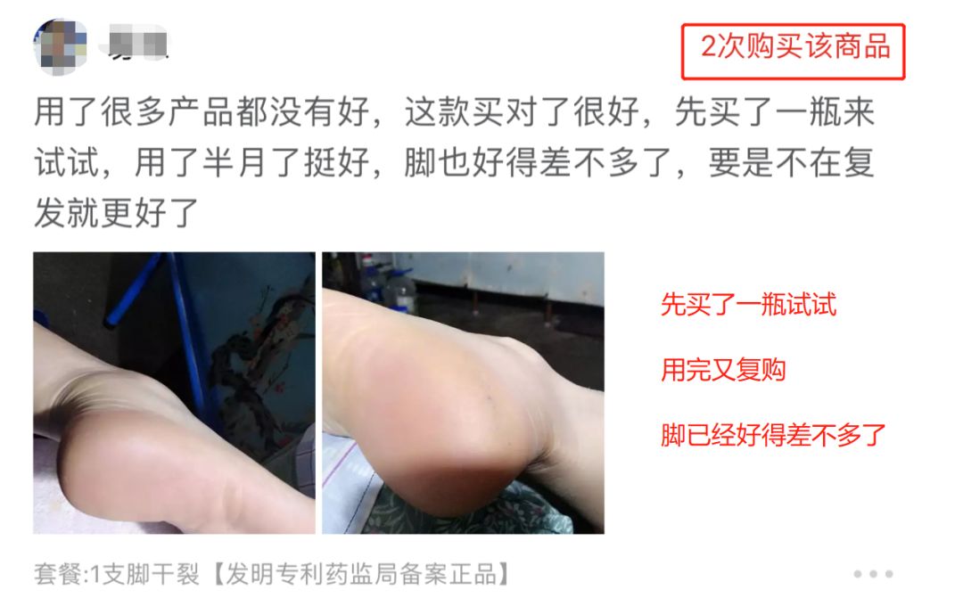 冬天脚后跟干裂用什么润脚霜,润足脚后跟干裂修复霜