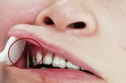 女司机下巴撞护栏情况,女司机撞栏杆下巴脱臼