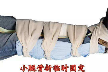 孩子骨折手法复位,孩子骨折了该如何自救