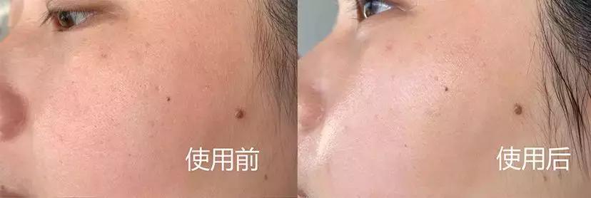 新西兰水光面膜,新西兰8分钟面膜三种颜色的功效